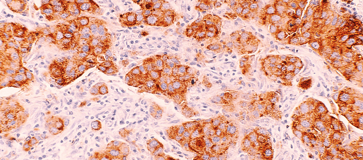 Understanding metabolic energy: the role of mitochondria in your health